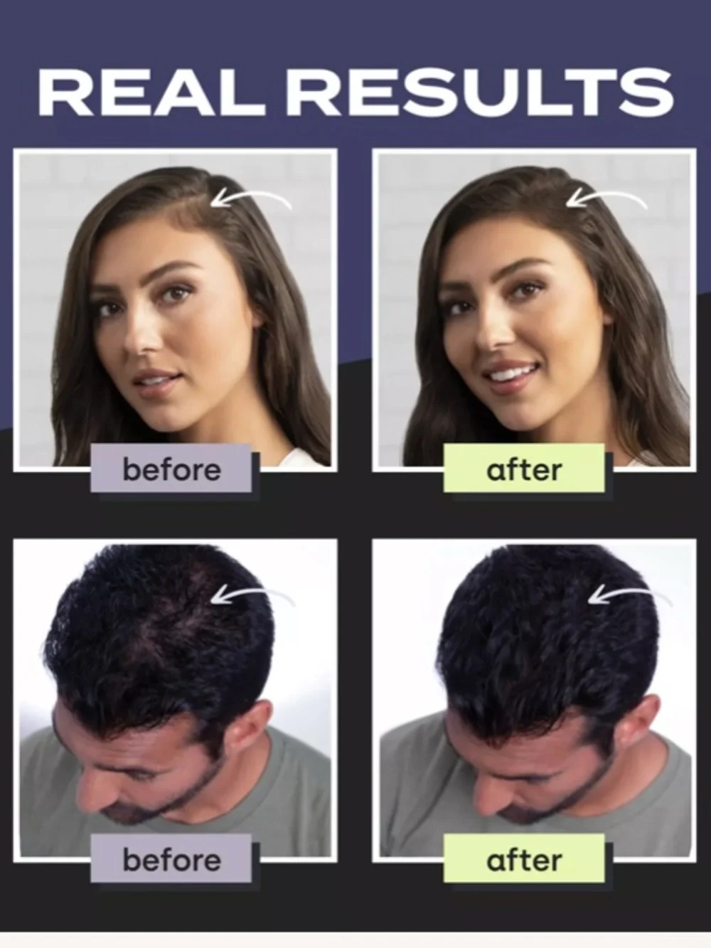 TOPPIK - Black Hair Building Fibers - Instant Hair Thickening - UNISEX